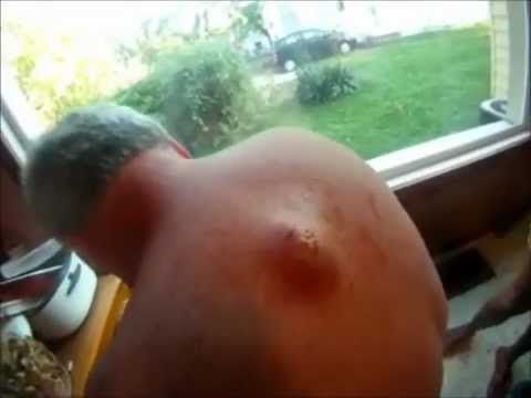 Verdens st�rste bums!